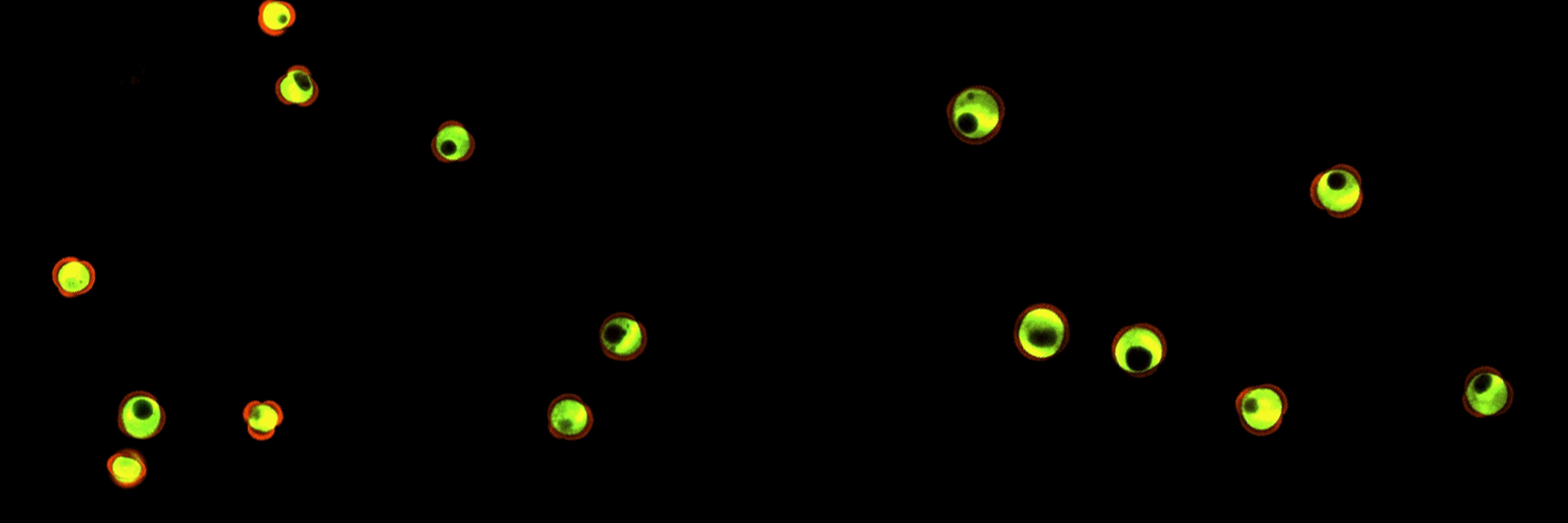 Confocal microscopy image of isolated microspore from Brassica napus flower buds.