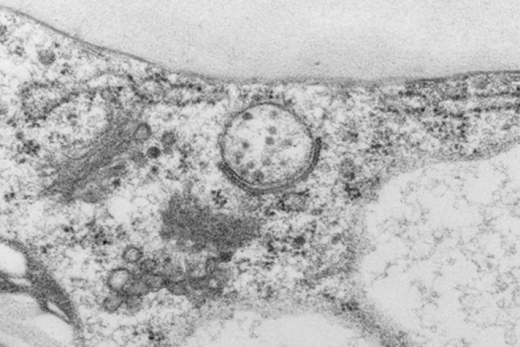 Transmission electron microscopy (TEM) image showing the formation of autophagosomes at endoplasmic reticulum-plasma membrane contact sites.