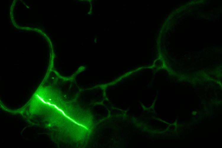 EH1-2 domain of AtEH1/Pan1 targeted to the cell plate in N. benthamiana