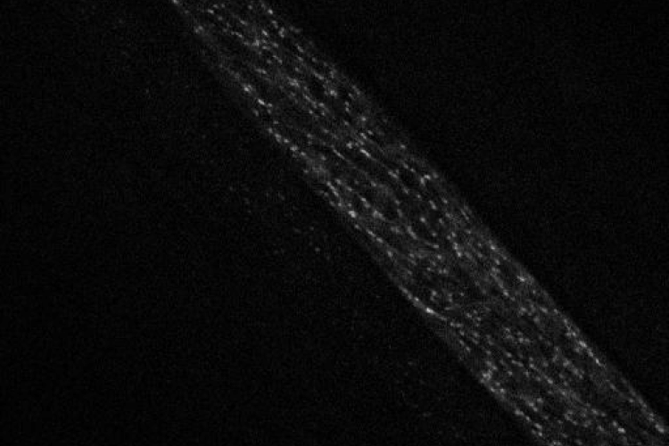 EB1a-labeled microtubule dynamics in Arabidopsis