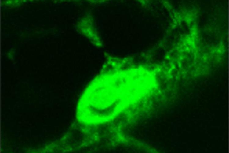 smiley nucleolus in BY-2