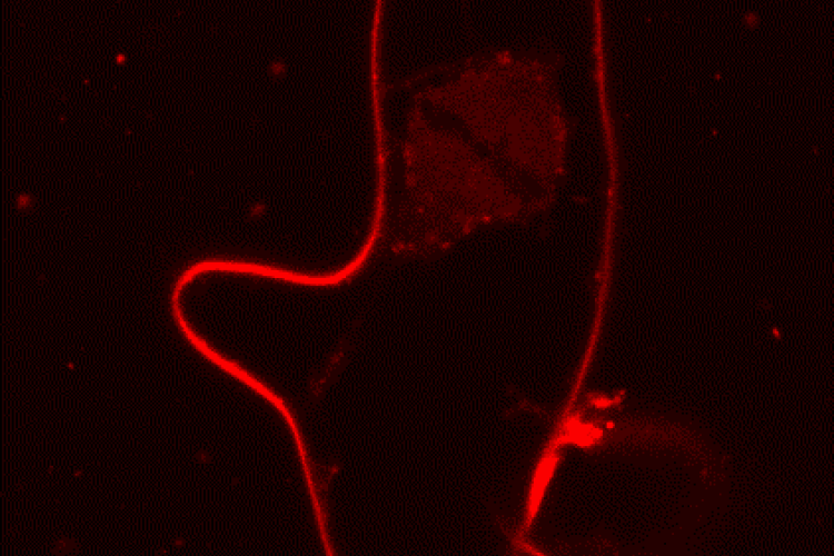 Tplate RNAi