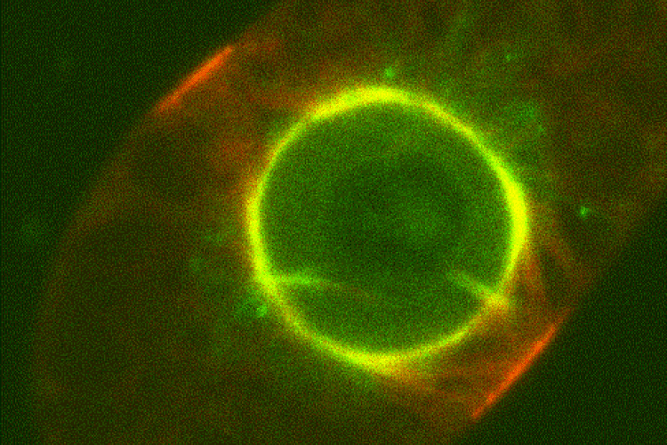 AtMAP65-4-GFP-and-RFP-TUA6-2-frames-per-sec