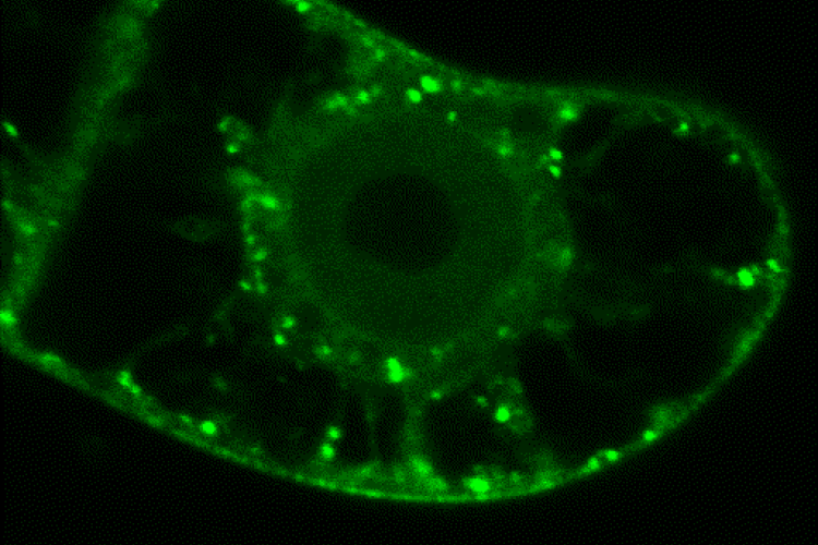 Tabacco cell labeled with CLC2-GFP