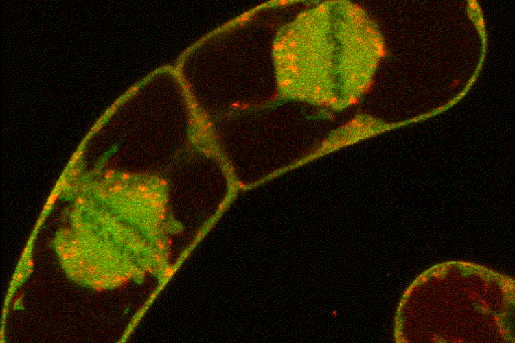 TPLATE-GFP and LC-mCherry timelapse 300 msec per frame