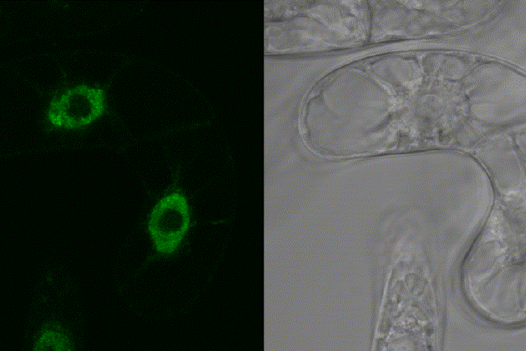 Dividing tabacco cell labeled KRP1-GFP 