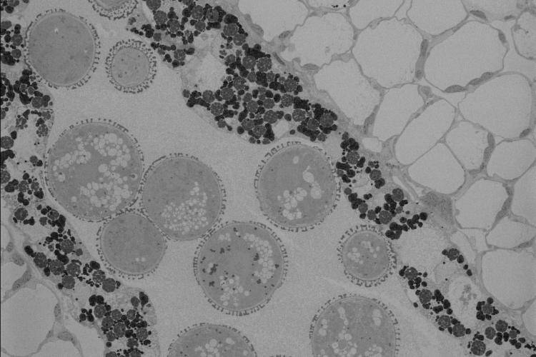 Arabidopsis anther and pollen