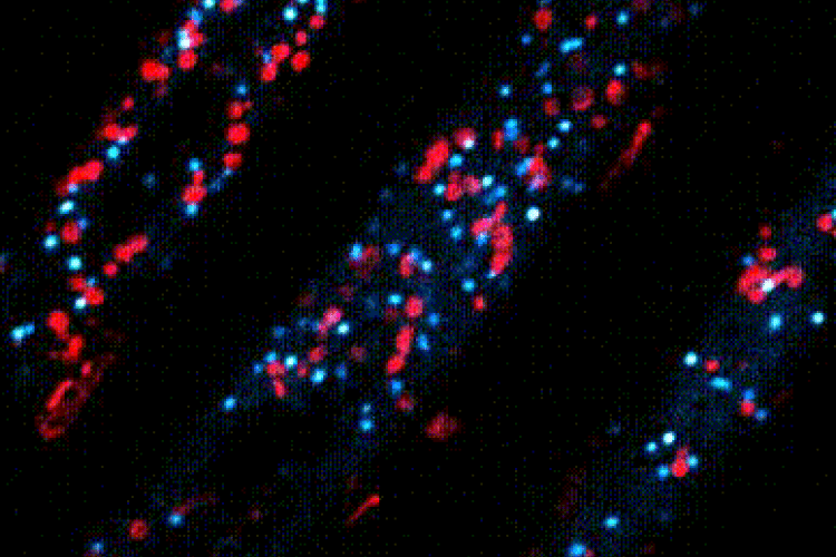 RabF2-GFP and ST-RFP_40fps